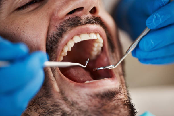 Best Emergency Dental Care for Sports Injuries in Somerville, TN