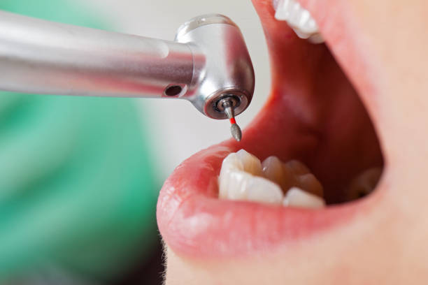 Best Broken or Chipped Tooth Repair in Somerville, TN